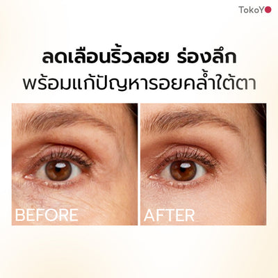 Mori Ruby Retinol Lift & Firming Set โมริ เซตรูบี้ เรตินอล ยกกระชับผิวหน้าและรอบดวงตา
